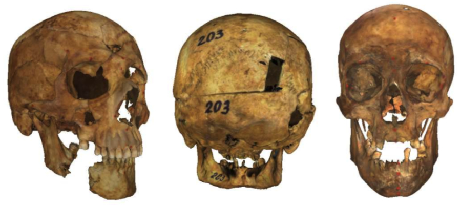 Automatic Landmark Location On Human Skulls Skeleton Id