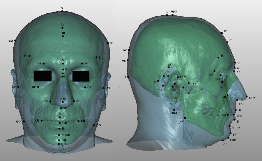 Facial landmarks